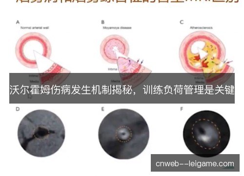 沃尔霍姆伤病发生机制揭秘，训练负荷管理是关键